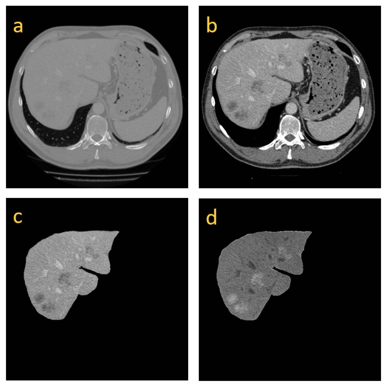 Algorithms 14 00144 g003 Algorithms 14 00144 g003