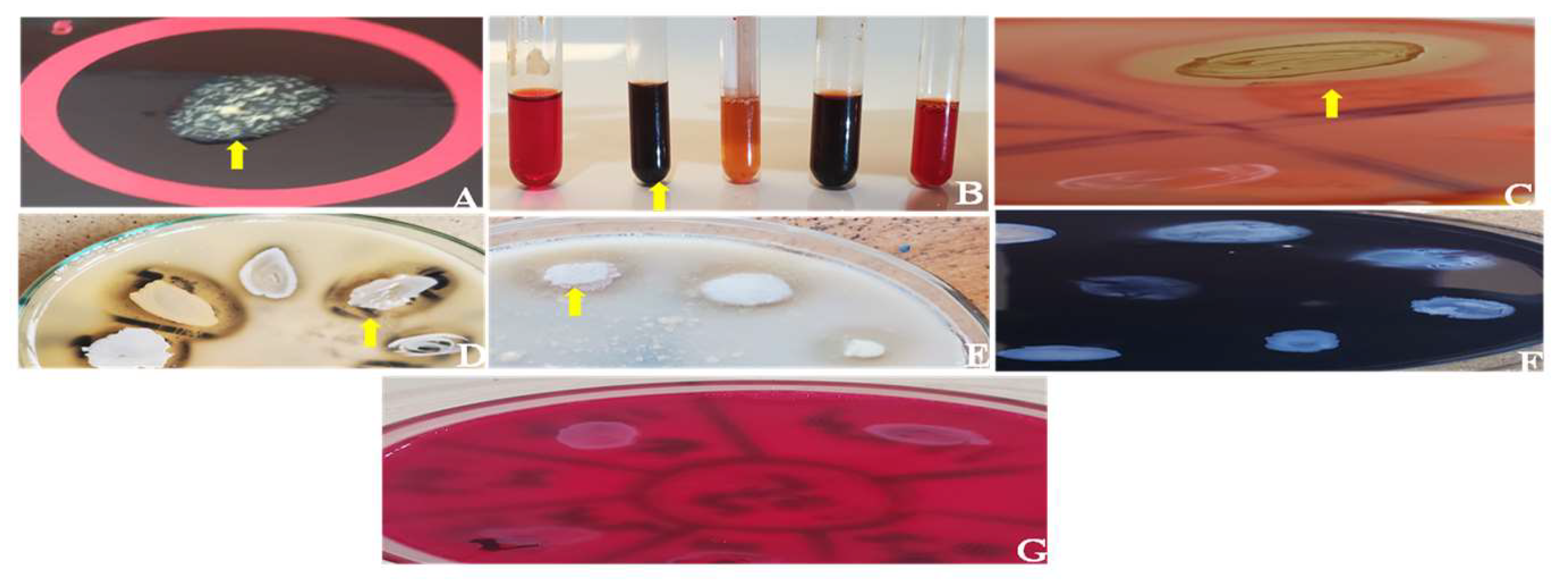 Antibiotics 12 00242 g002