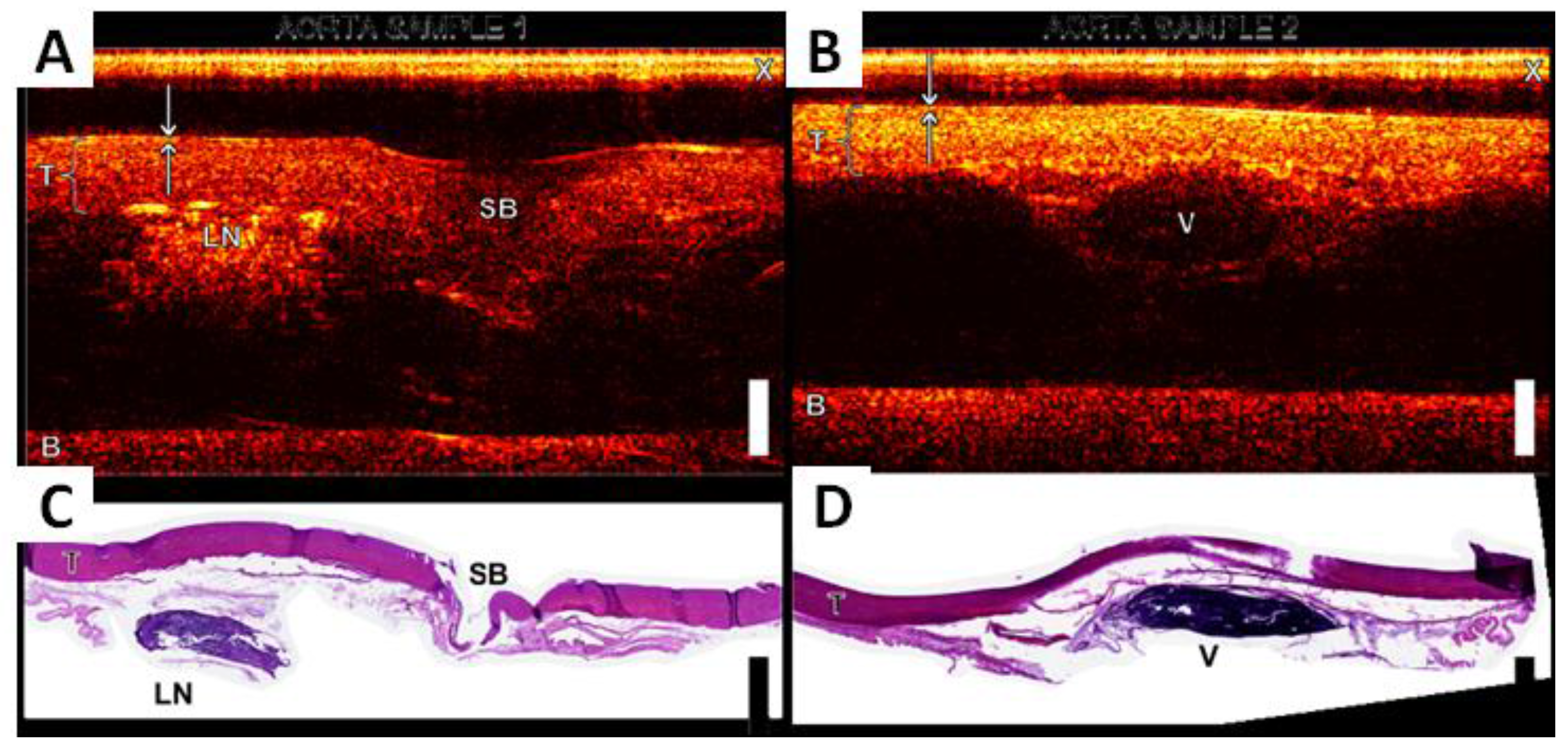 Applied Sciences Free FullText Review of LaserGenerated