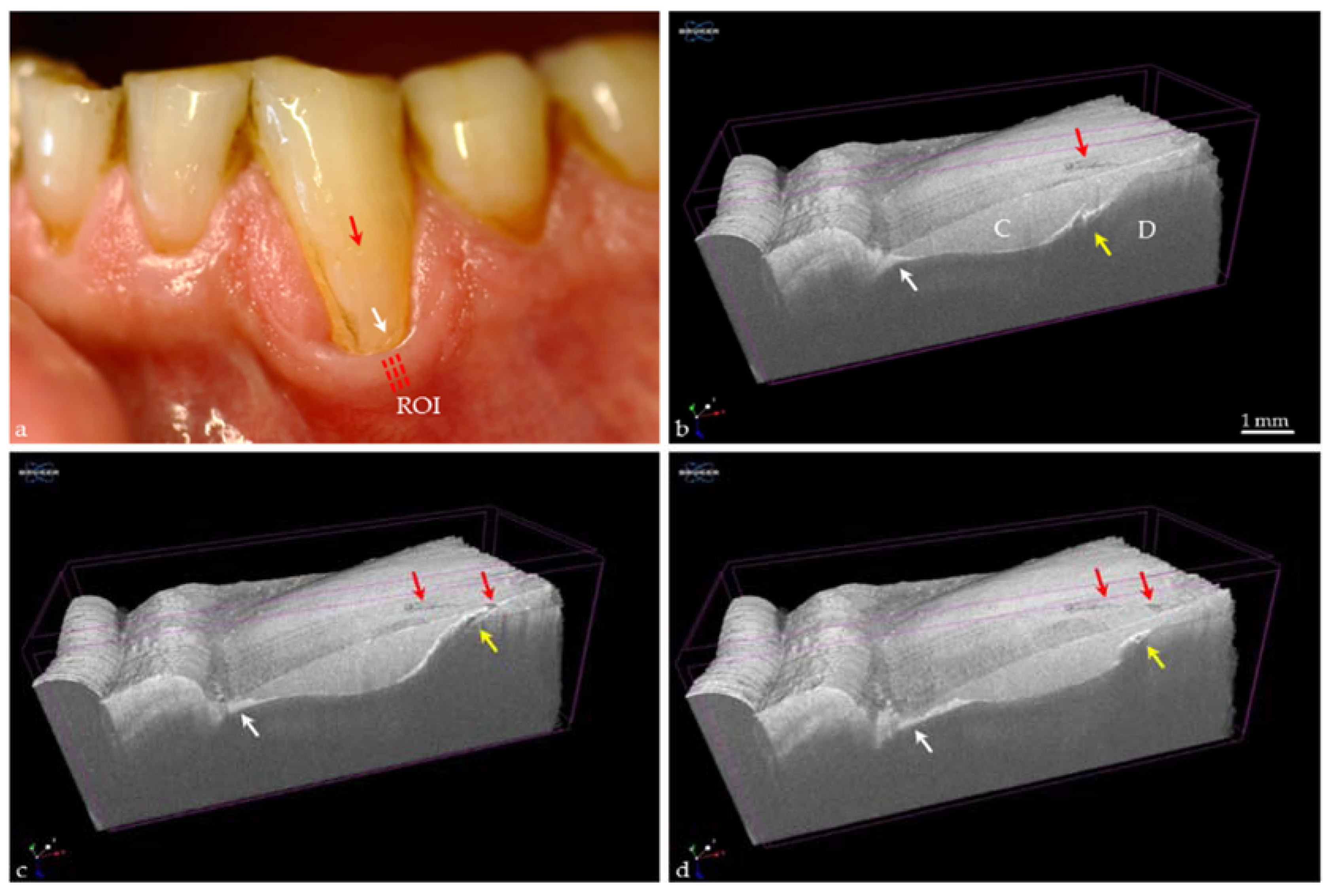 Applied Sciences Free FullText Dental Applications of Optical