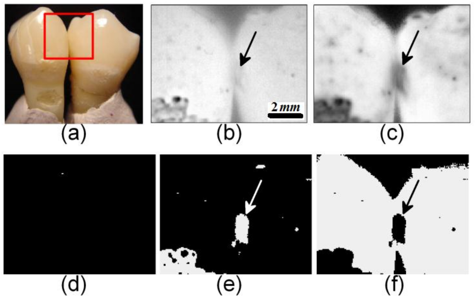 Applsci 08 00581 g011