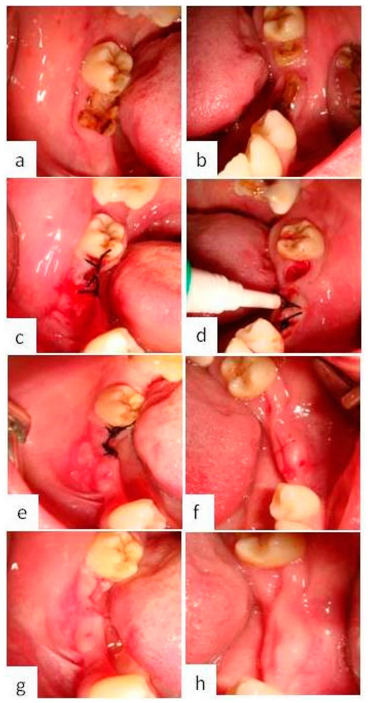 Applsci 10 01105 g001 Applsci 10 01105 g001