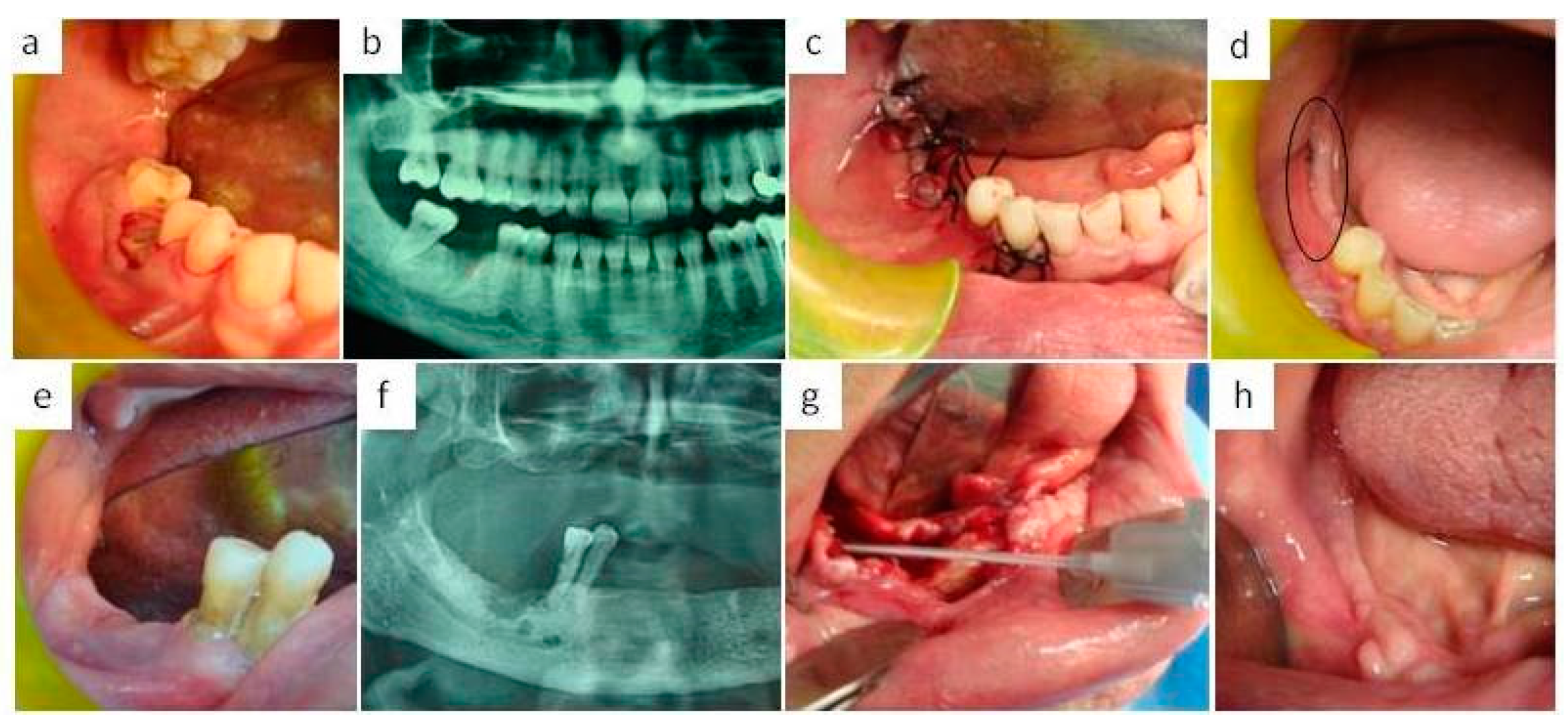 Applsci 10 01105 g002 Applsci 10 01105 g002