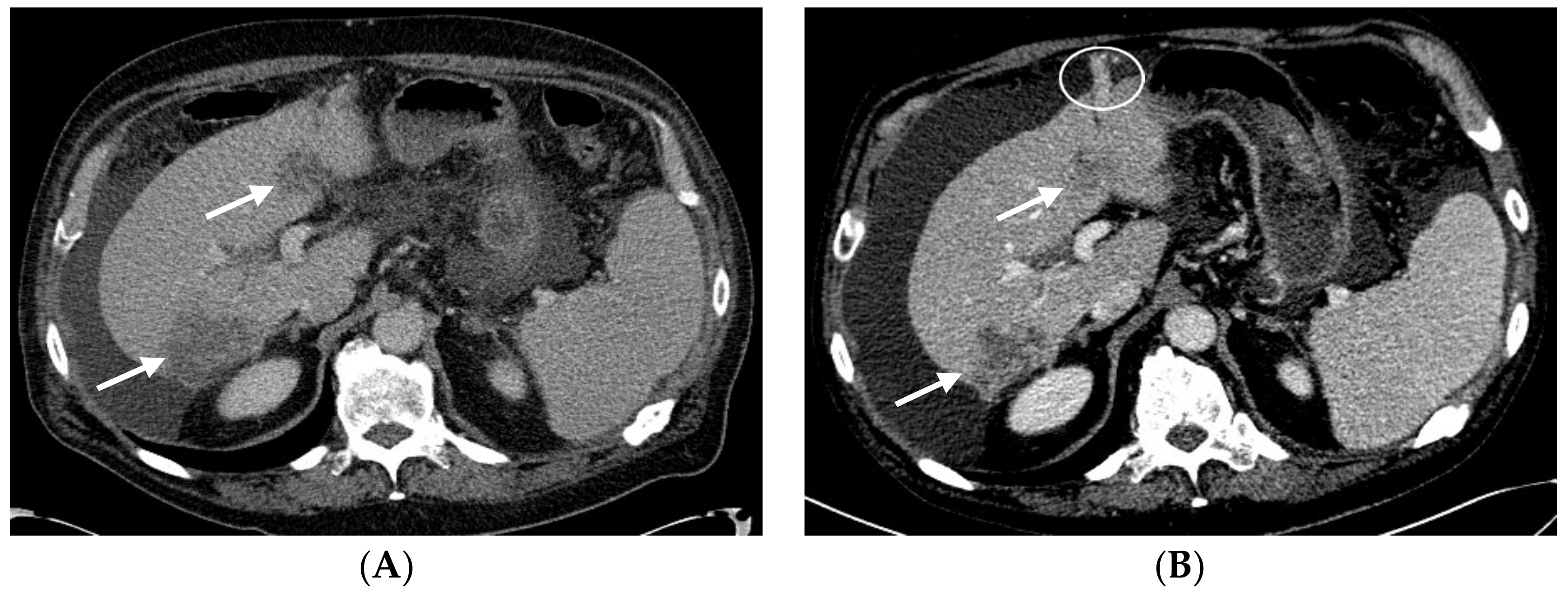 Biomedicines 06 00046 g004