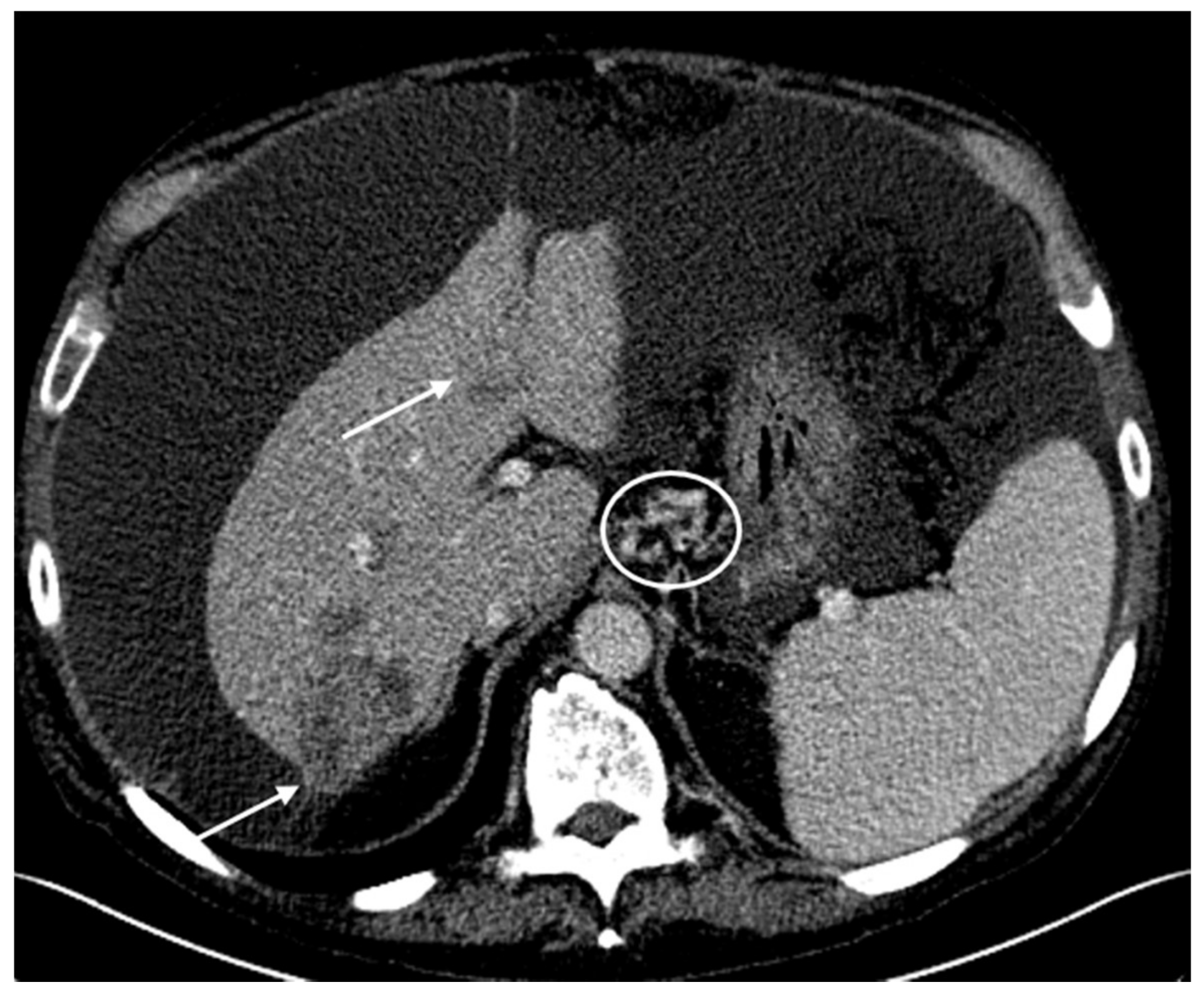 Biomedicines 06 00046 g005
