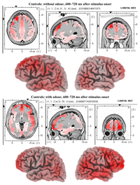 Brainsci 01 00003f4 200