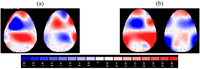Brainsci 02 00085 g001 200