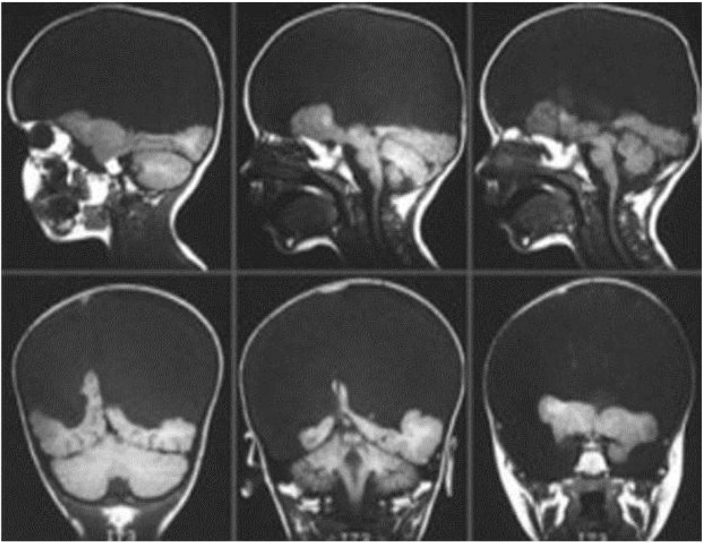 Brainsci 02 00147 g007 1024