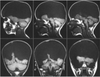 Brainsci 02 00147 g007 200