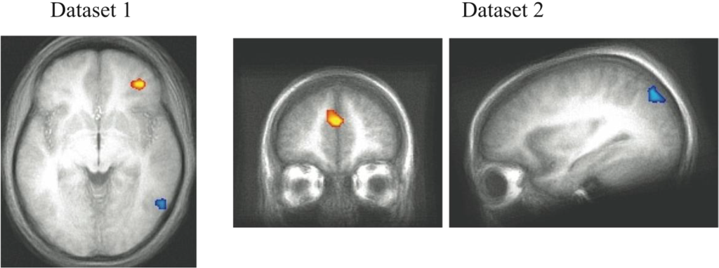 Brainsci 02 00176 g004 1024