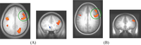Brainsci 02 00176 g005 200