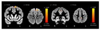 Brainsci 02 00553 g003 200