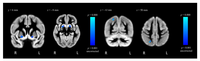 Brainsci 02 00553 g004 200
