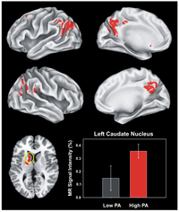 Brainsci 03 00054 g003 200