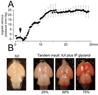Brainsci 03 00215 g002 200