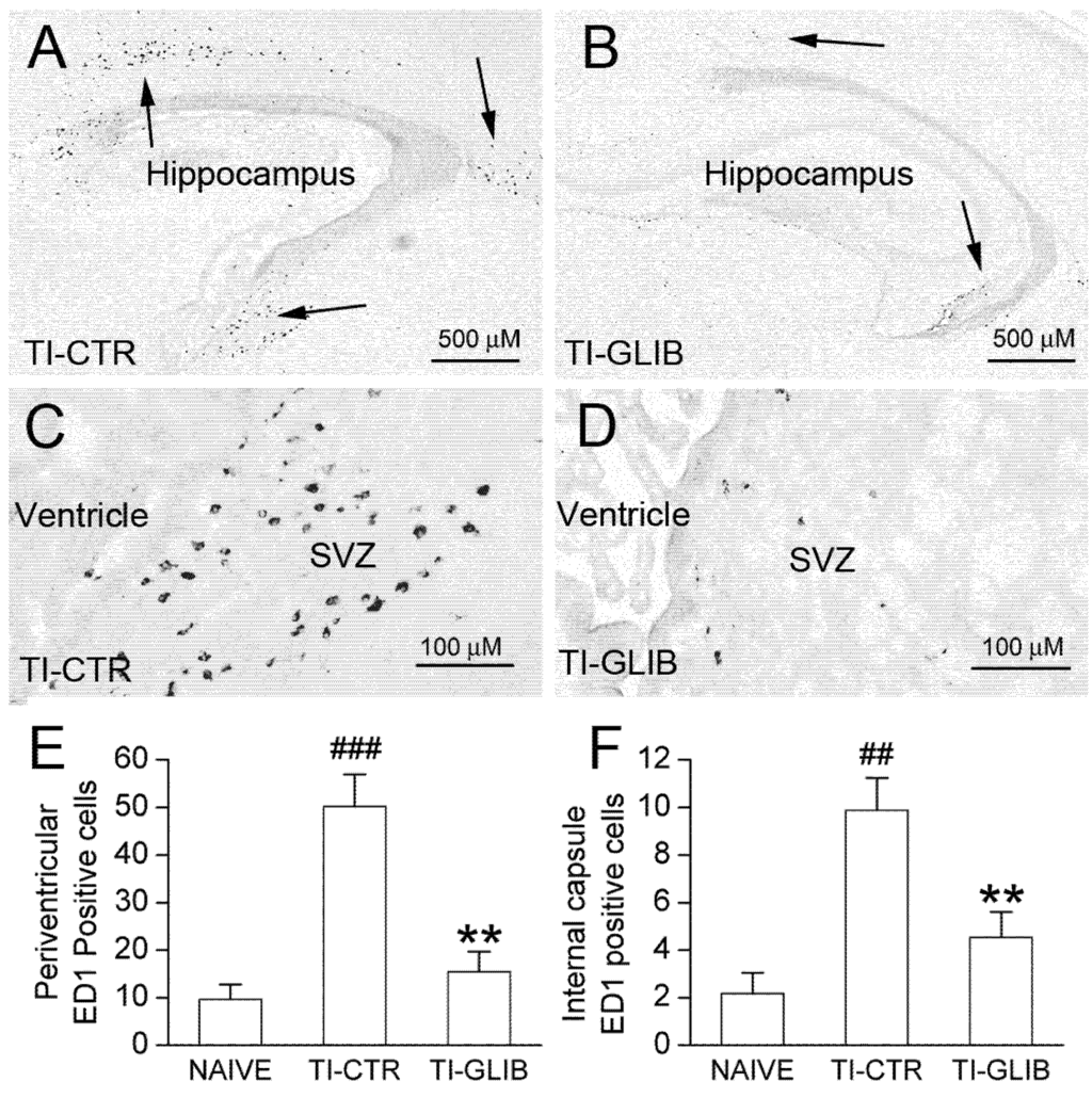 Brainsci 03 00215 g006 1024