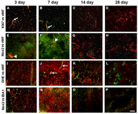 Brainsci 03 00294 g006 200