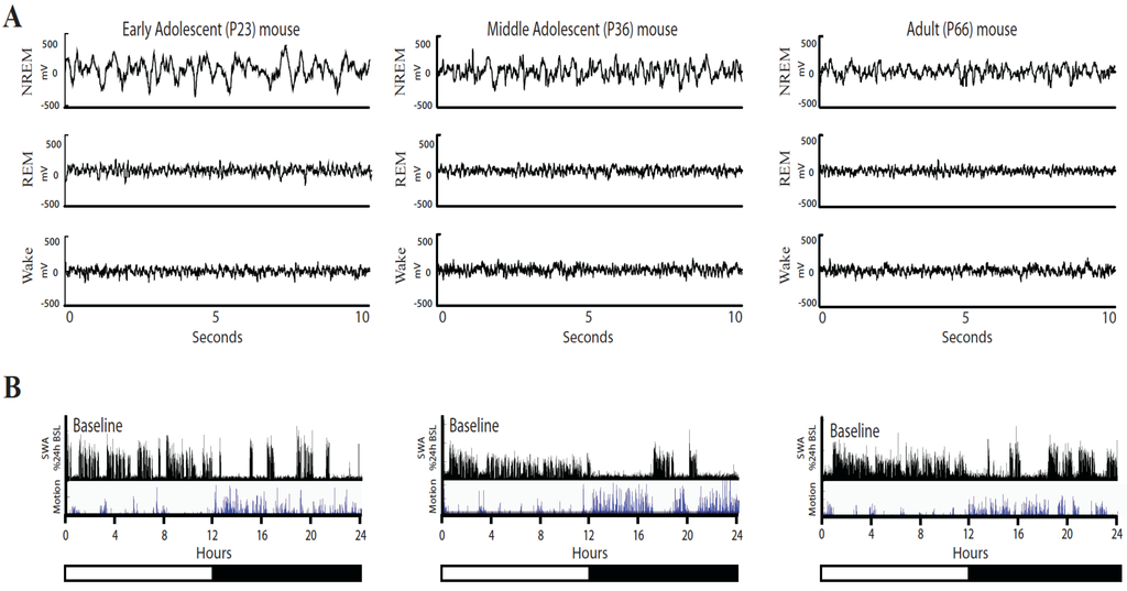 Brainsci 03 00318 g001 1024