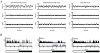 Brainsci 03 00318 g001 200