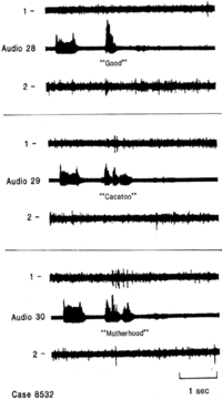 Brainsci 03 00627 g003 200