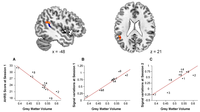 Brainsci 03 00728 g004 200