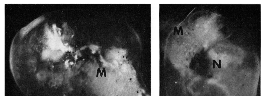 Brainsci 03 00800 g002 1024