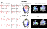 Brainsci 03 00908 g001 200