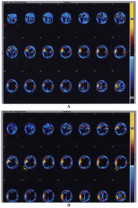 Brainsci 03 01013 g001 200