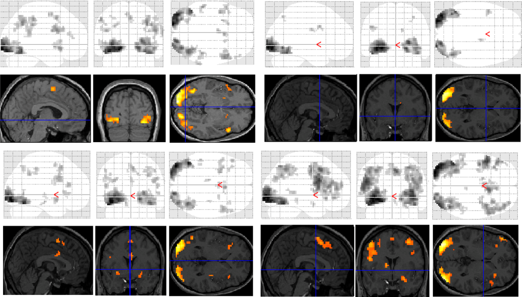 Brainsci 03 01060 g001 1024