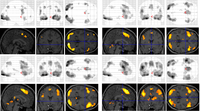 Brainsci 03 01060 g002 200