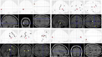 Brainsci 03 01060 g003 200