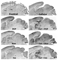 Brainsci 03 01128 g005 200