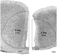 Brainsci 03 01153 g006 200
