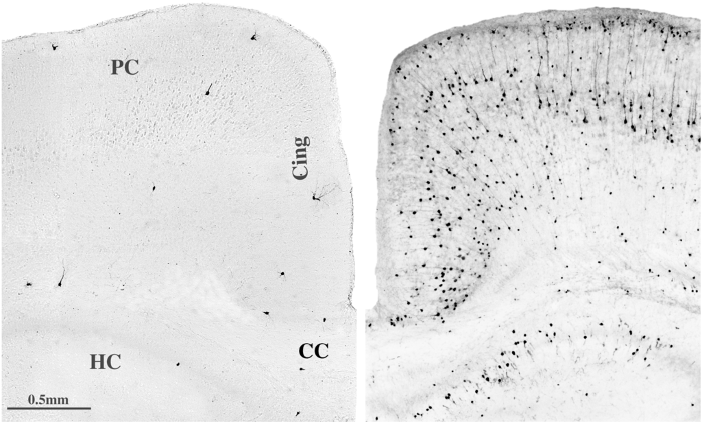 Brainsci 03 01153 g007 1024