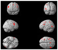 Brainsci 03 01198 g001 200