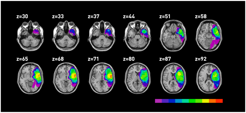 Brainsci 03 01229 g003 1024