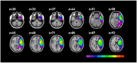 Brainsci 03 01229 g003 200