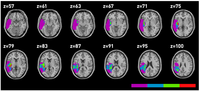 Brainsci 03 01229 g004 200