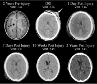 Brainsci 03 01374 g001 200