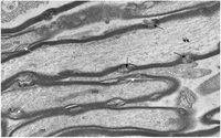 Brainsci 03 01374 g004 200