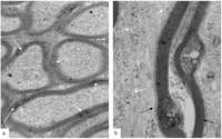 Brainsci 03 01374 g005 200