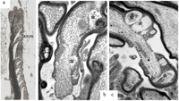 Brainsci 03 01374 g007 200