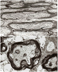 Brainsci 03 01374 g008 200