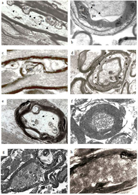 Brainsci 03 01374 g009 200