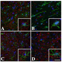 Brainsci 03 01417 g001 200