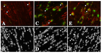 Brainsci 03 01417 g004 200
