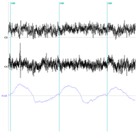 Brainsci 03 01554 g003 200
