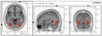 Brainsci 03 01569 g001 200