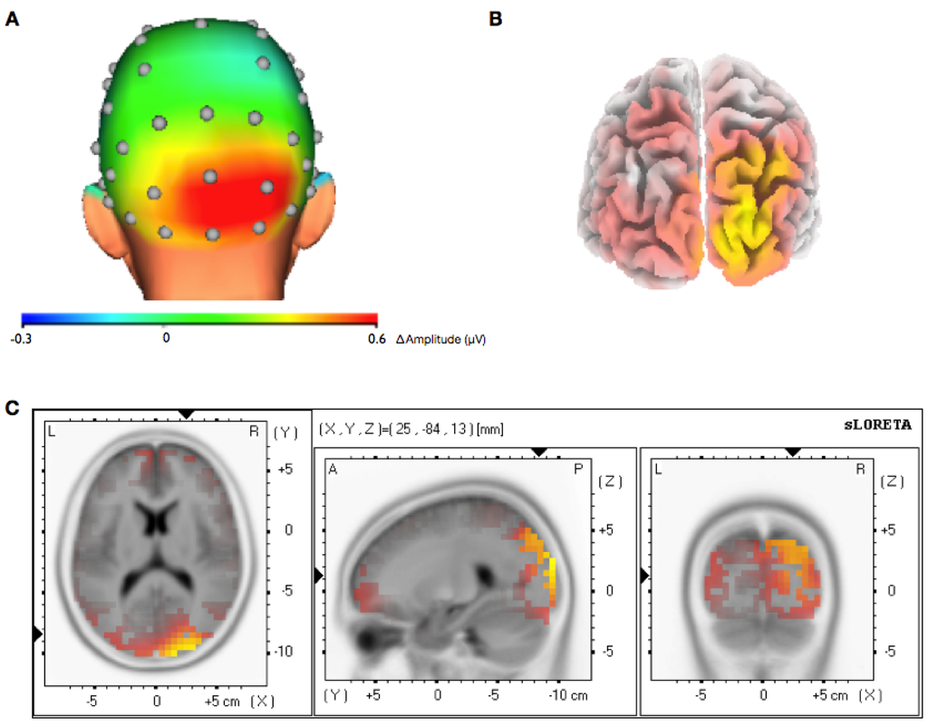 Brainsci 03 01569 g005 1024