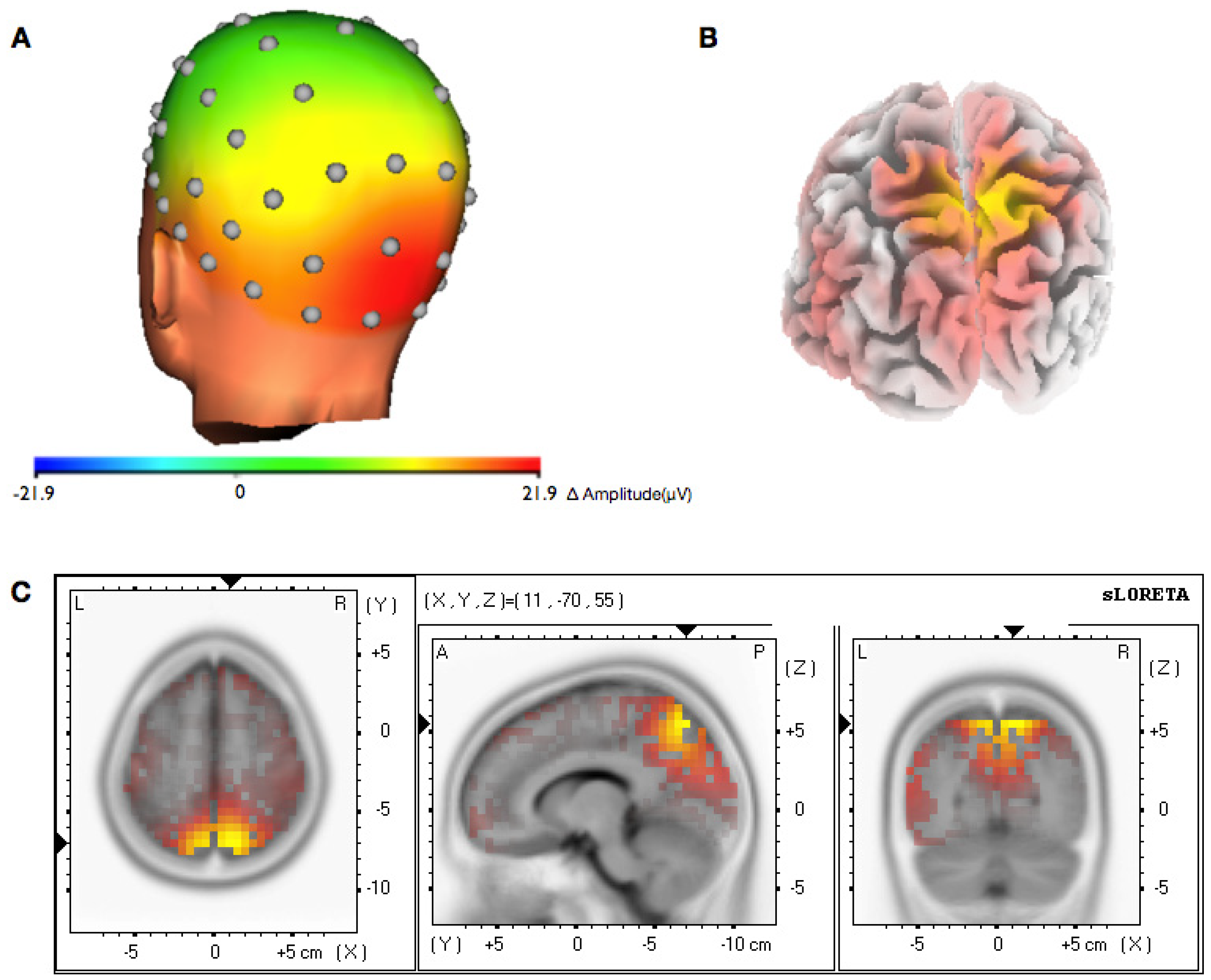 Brainsci 03 01569 g006
